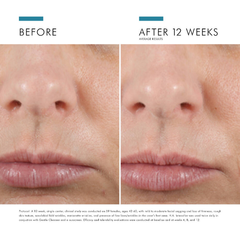 HA Intensifier Hyaluronic Acid Serum