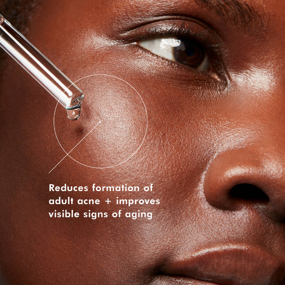 Blemish and Age Defense Salicylic Acid Serum