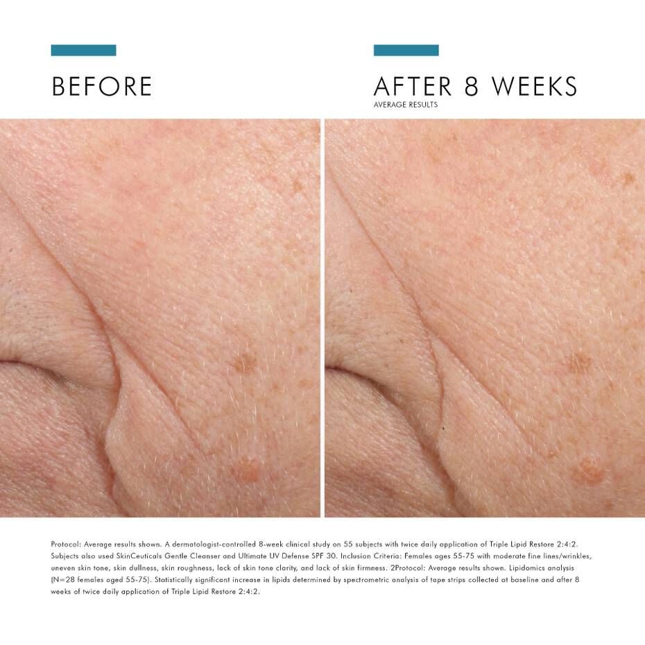Triple Lipid Restore 242 Anti Ageing Moisturiser