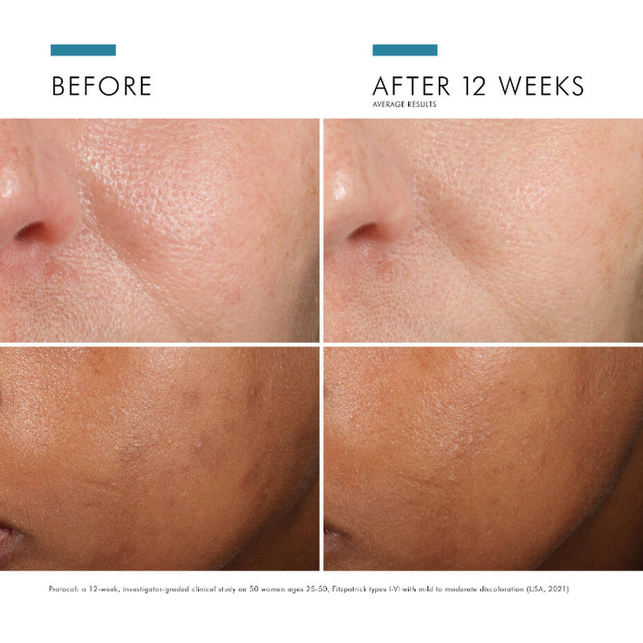 Phloretin CF Vitamin C Serum
