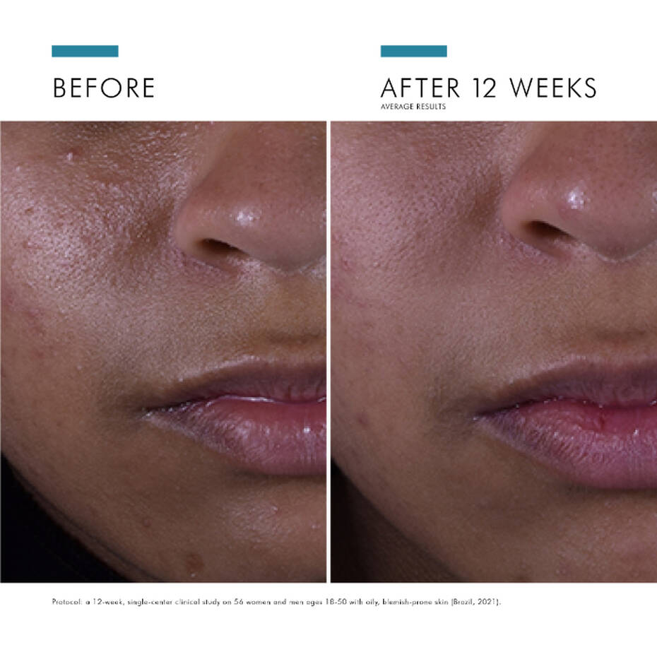 Silymarin CF Vitamin C Serum