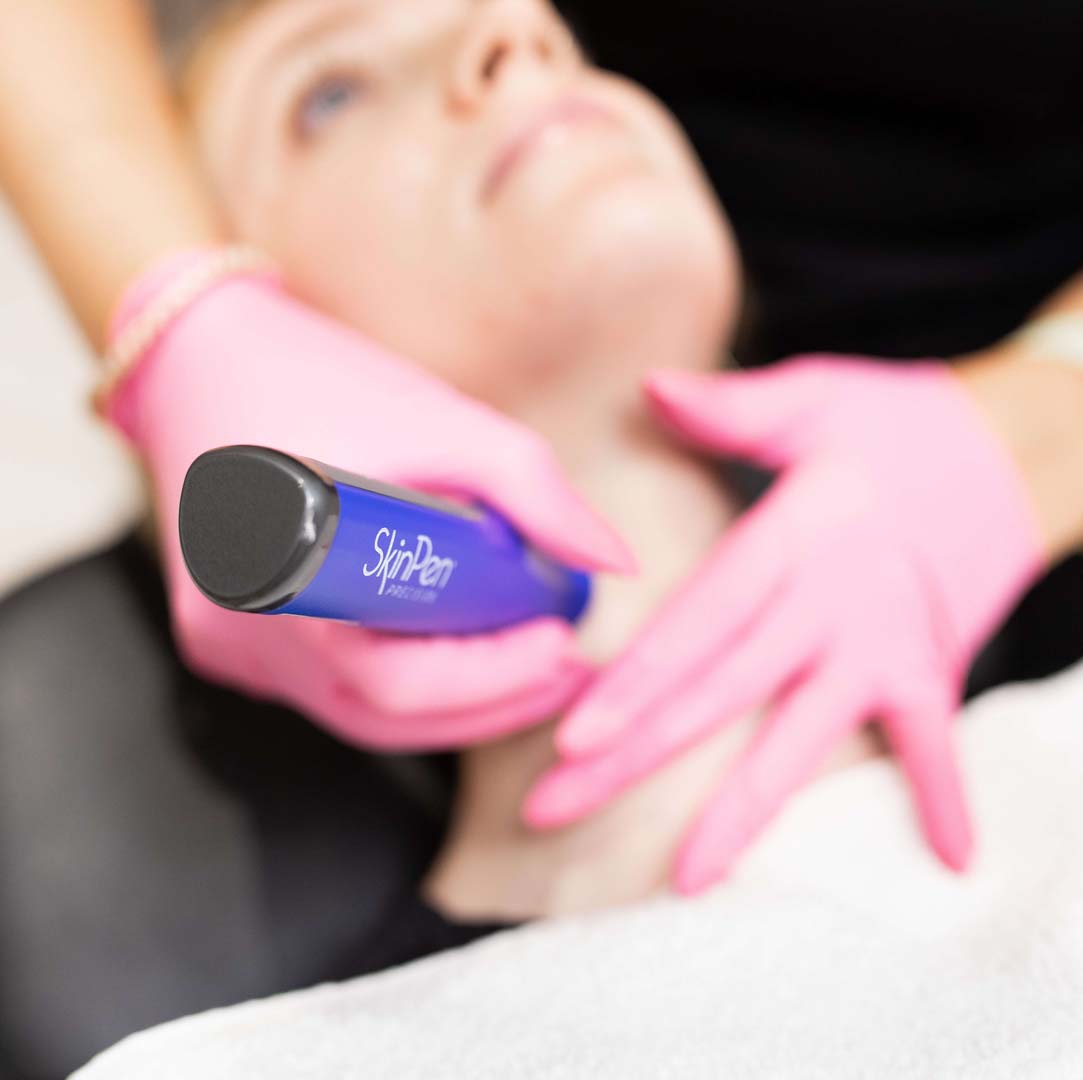 SkinPen Needling โ About Face Cosmetics