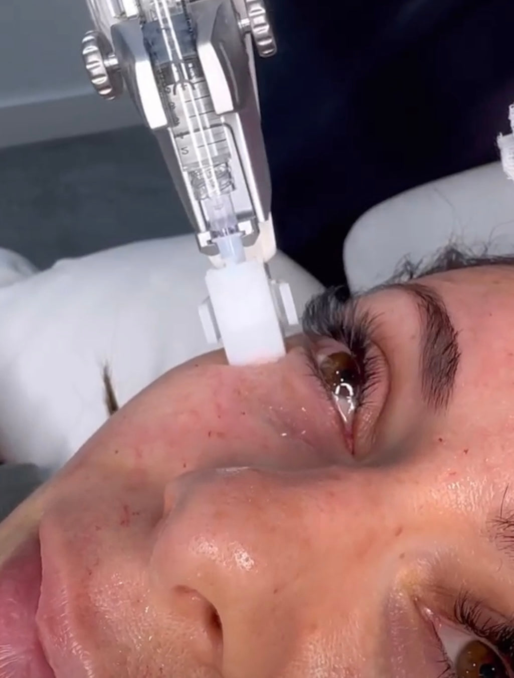 Glass Skin