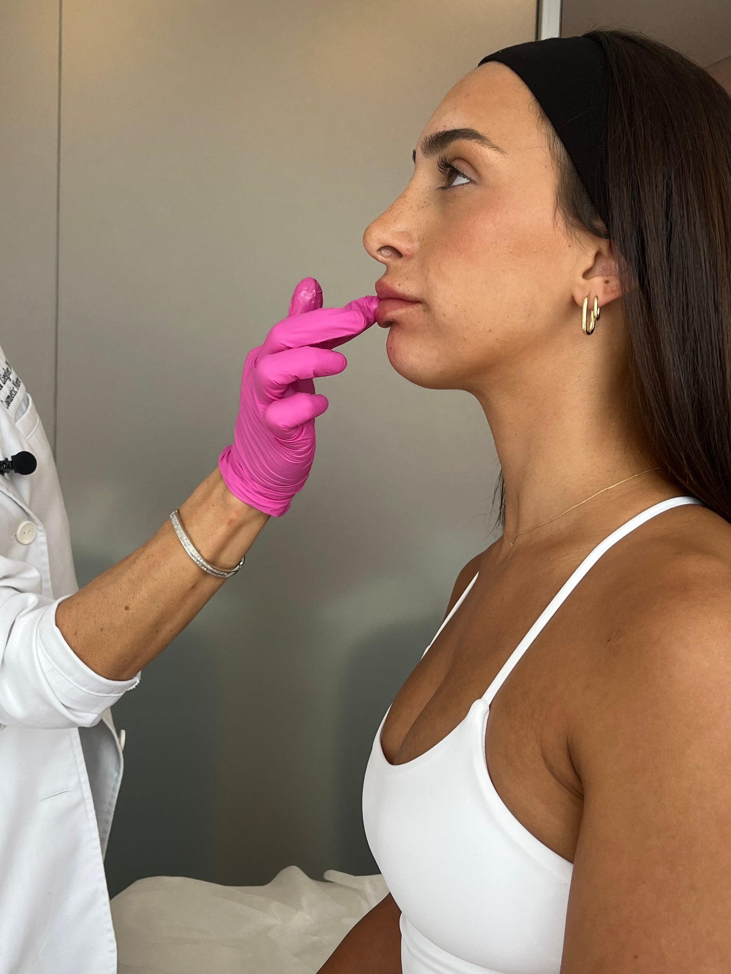 Facial Volume Loss Consultation